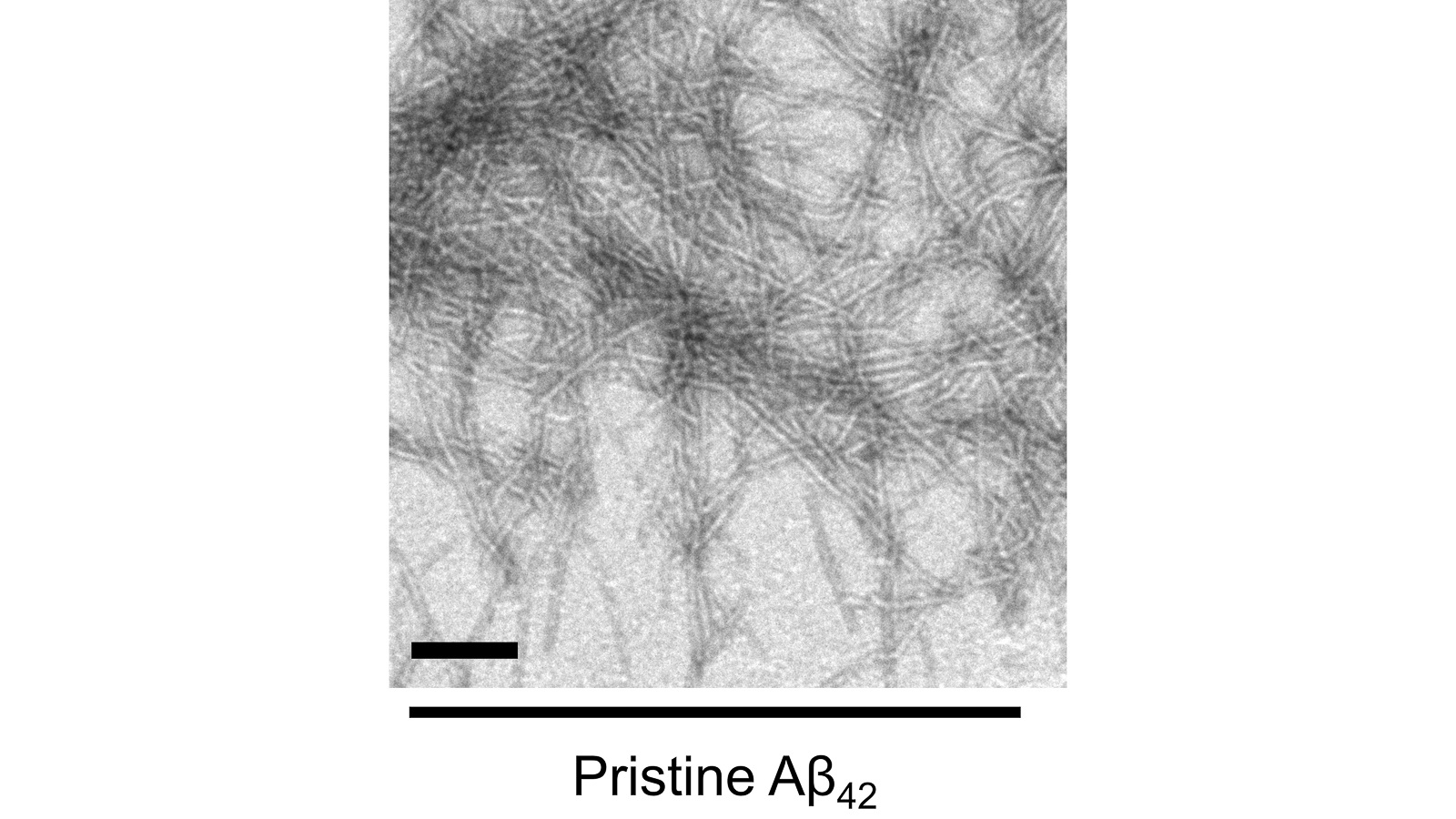 Transmission Electron Microscopy (TEM) images of Aβ peptide samples in the absence of the Aβ nanodevices (scale bar: 200 nm). The grains in the image are the peptides that, when left together, are prone to self-aggregation. (Image by Argonne’s Center for Nanoscale Materials.)