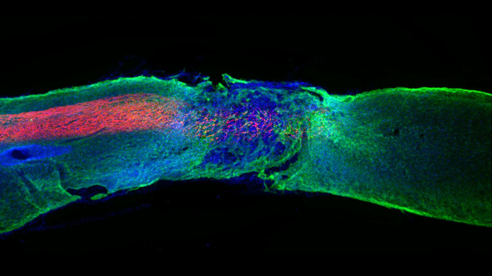 Axons (red) regenerated within a damaged area of the spinal cord after being treated with a new therapy developed by Northwestern researchers with the help of the Advanced Photon source at Argonne National Laboratory. (Image by Samuel I. Stupp Laboratory/Northwestern University.)