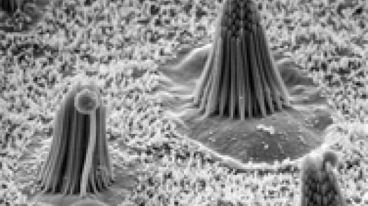 Inner ear hair cells that convert a mechanical stimulus-like sound or head movement into neural signals.