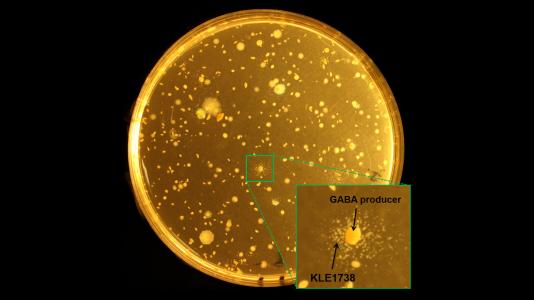 Scientists seeded this petri plate with KLE1738 and bacteria from human stool. KLE1738 is dependent upon gamma-aminobutyric acid (GABA), an inhibitory neurotransmitter found in mammalian central nervous systems. Any colony that supports growth of KLE1738 is a GABA-producer. Many colonies on this plate are producing GABA. (Image courtesy of Philip Strandwitz / Northeastern University.)